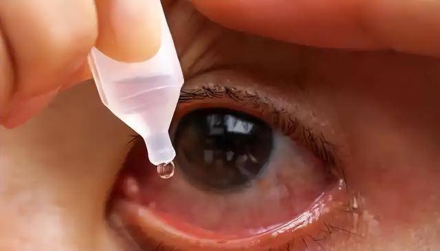 眼睛干澀與長時間吹空調有何關系<strong></p>
<p>室內環境改善
</strong>？如何改善室內環境？:室內環境改善
